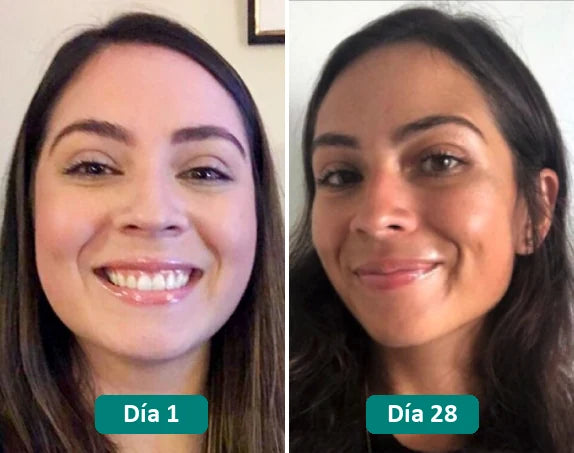Antes y después: día 1 y día 28
