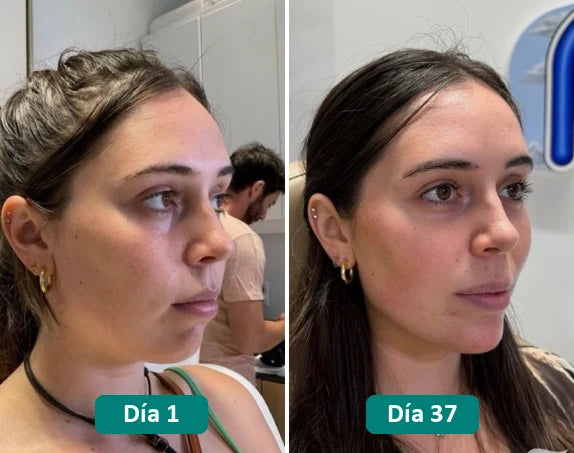 Antes y después: día 1 y día 37