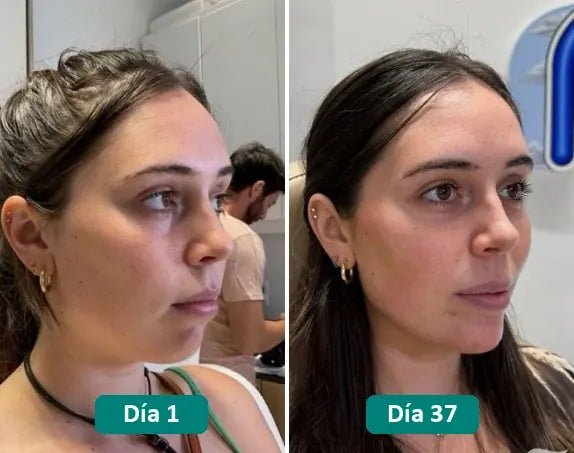 Antes y después: día 1 y día 37