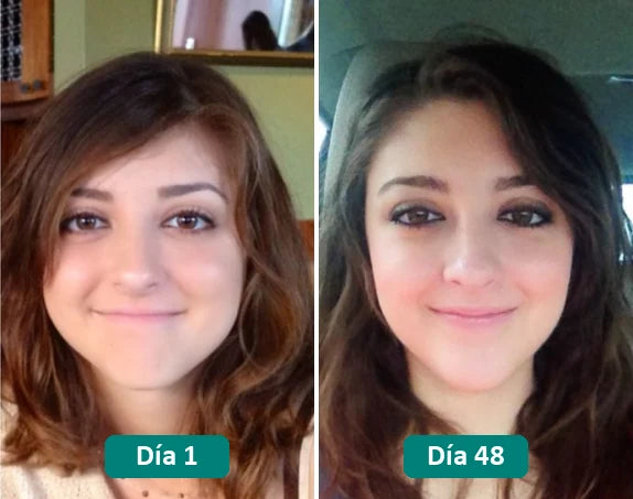Antes y después: día 1 y día 48
