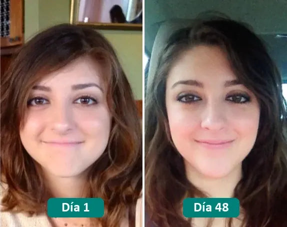 Antes y después: día 1 y día 48